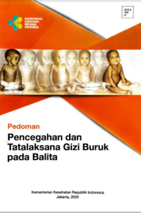 Image of Ebook Pedoman Pencegahan dan Tatalaksana Gizi Buruk pada Balita