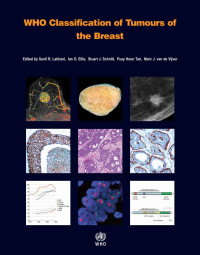 Image of Ebook WHO Classification of Tumours of the Breast